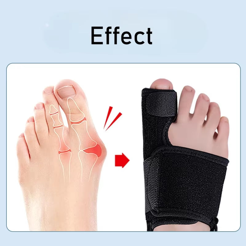 1PC Flexible Splint Separator Hallux Valgus Bunion Corrector Orthotics Feet Bone Thumb Adjuster Correction Pedicure Straightener